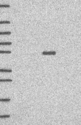 Western Blot: LRRC2 Antibody [NBP3-17881] - Lane 1: Marker [kDa] 250, 130, 95, 72, 55, 36, 28, 17, 10;   Lane 2: RT4;   Lane 3: U-251 MG;   Lane 4: Human Plasma;   Lane 5: Liver;   Lane 6: Tonsil