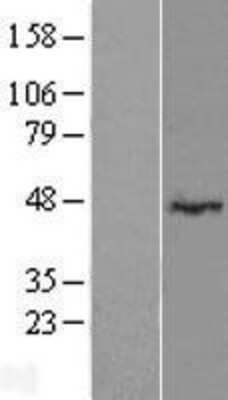 Western Blot: LRRC2 Overexpression Lysate (Adult Normal) [NBP2-06326] Left-Empty vector transfected control cell lysate (HEK293 cell lysate); Right -Over-expression Lysate for LRRC2.