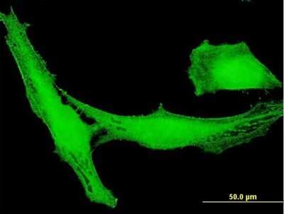 Immunocytochemistry/Immunofluorescence: LRRC23 Antibody [H00010233-B01P] - Analysis of purified antibody to LRRC23 on HeLa cell. (antibody concentration 10 ug/ml)