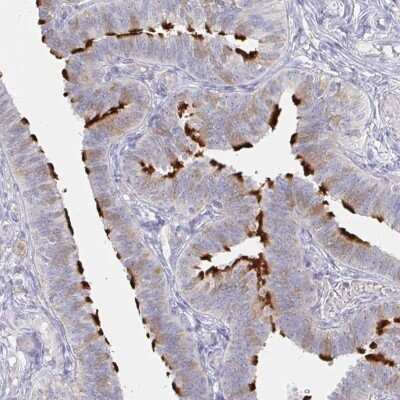 Immunohistochemistry-Paraffin: LRRC23 Antibody [NBP2-38827] - Staining of human fallopian tube shows high expression.
