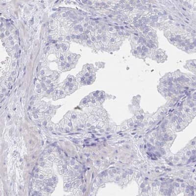 Immunohistochemistry-Paraffin: LRRC23 Antibody [NBP2-38827] - Staining of human prostate shows low expression as expected.