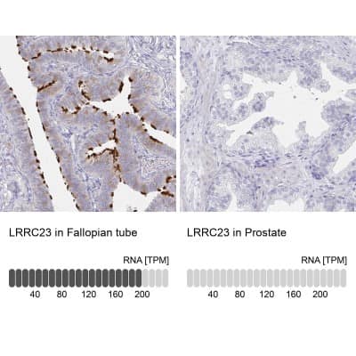 <b>Orthogonal Strategies Validation. </b>Immunohistochemistry-Paraffin: LRRC23 Antibody [NBP2-38827] - Staining in human fallopian tube and prostate tissues using anti-LRRC23 antibody. Corresponding LRRC23 RNA-seq data are presented for the same tissues.