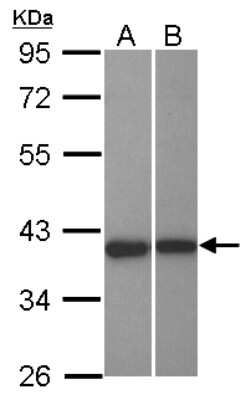 Western Blot: LRRC23 Antibody [NBP2-17170] - Sample (30 ug of whole cell lysate) A: NT2D1 B: U87-MG 10% SDS PAGE gel, diluted at 1:1000.