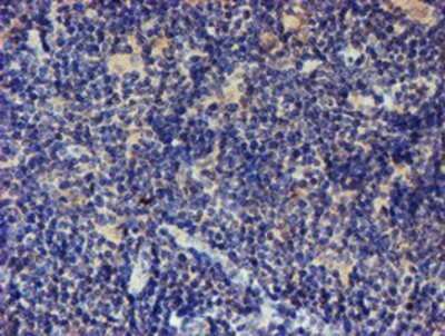 Immunohistochemistry: LRRC25 Antibody (OTI1D9) - Azide and BSA Free [NBP2-72523] - Staining of paraffin-embedded Human lymphoma tissue using anti-LRRC25 mouse monoclonal antibody.