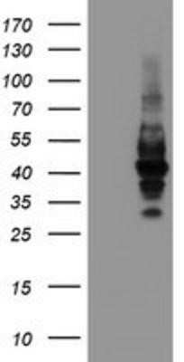 Western Blot: LRRC25 Antibody (OTI1D9) - Azide and BSA Free [NBP2-72523] - HEK293T cells were transfected with the pCMV6-ENTRY control (Left lane) or pCMV6-ENTRY LRRC25 (Right lane) cDNA for 48 hrs and lysed. Equivalent amounts of cell lysates (5 ug per lane) were separated by SDS-PAGE and immunoblotted with anti-LRRC25.