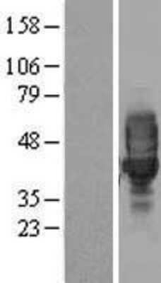 Western Blot: LRRC25 Overexpression Lysate (Adult Normal) [NBL1-12682] Left-Empty vector transfected control cell lysate (HEK293 cell lysate); Right -Over-expression Lysate for LRRC25.