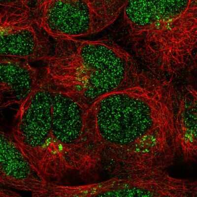 Immunocytochemistry/ Immunofluorescence LRRC28 Antibody