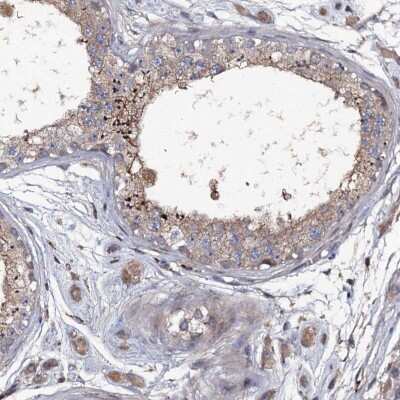 Immunohistochemistry-Paraffin LRRC28 Antibody