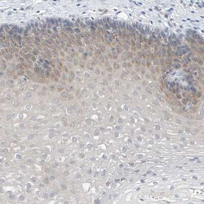 Immunohistochemistry-Paraffin LRRC29 Antibody - BSA Free