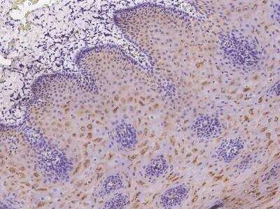 Immunohistochemistry-Paraffin: LRRC29 Antibody [NBP3-05972] - Staining of human LRRC29 in human esophagus with rabbit polyclonal antibody at 1:200 dilution.