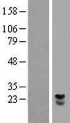 Western Blot: LRRC29 Overexpression Lysate (Adult Normal) [NBL1-12684] Left-Empty vector transfected control cell lysate (HEK293 cell lysate); Right -Over-expression Lysate for LRRC29.