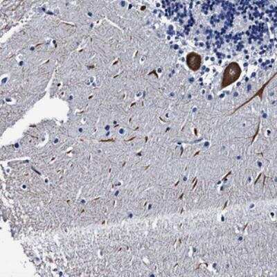 Immunohistochemistry: LRRC30 Antibody [NBP2-30598] - Staining of human cerebellum shows strong cytoplasmic positivity in Purkinje cells.