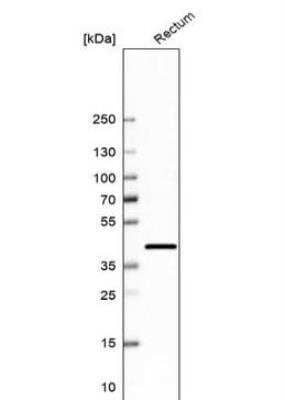 Western Blot: LRRC31 Antibody [NBP1-93932] - Analysis in human rectum tissue.