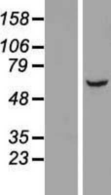 Western Blot: LRRC31 Overexpression Lysate (Adult Normal) [NBP2-06295] Left-Empty vector transfected control cell lysate (HEK293 cell lysate); Right -Over-expression Lysate for LRRC31.