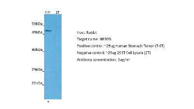 Western Blot: LRRC33 Antibody [NBP2-83151] - Host: Rabbit. Target: NRROS. Positive control (+): Human Stomach Tumor (T-ST). Negative control (-): 293T Cell Lysate (2T). Antibody concentration: 3ug/ml