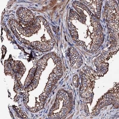 Immunohistochemistry-Paraffin: LRRC35 Antibody [NBP2-34051] - Staining of human prostate shows strong cytoplasmic and membranous positivity in glandular cells.