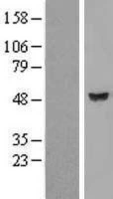 Western Blot: LRRC35 Overexpression Lysate (Adult Normal) [NBP2-11107] Left-Empty vector transfected control cell lysate (HEK293 cell lysate); Right -Over-expression Lysate for LRRC35.