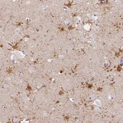 Immunohistochemistry: LRRC36 Antibody [NBP2-31597] - Staining of human lateral ventricle shows strong cytoplasmic and nuclear positivity in astrocytes.