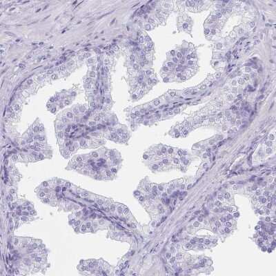 Immunohistochemistry-Paraffin: LRRC36 Antibody [NBP2-31721] - Staining of human prostate shows low expression as expected.