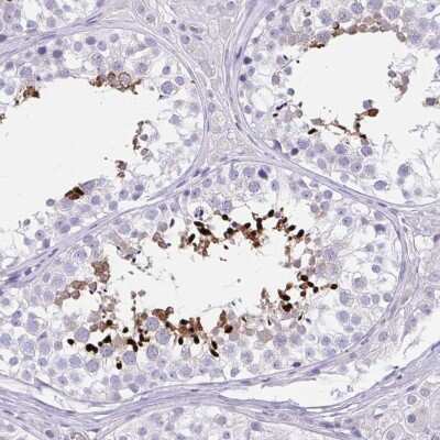 Immunohistochemistry-Paraffin: LRRC36 Antibody [NBP2-31721] - Staining of human testis shows high expression.