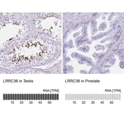 <b>Orthogonal Strategies Validation. </b>Immunohistochemistry-Paraffin: LRRC36 Antibody [NBP2-31721] - Staining in human testis and prostate tissues using anti-LRRC36 antibody. Corresponding LRRC36 RNA-seq data are presented for the same tissues.