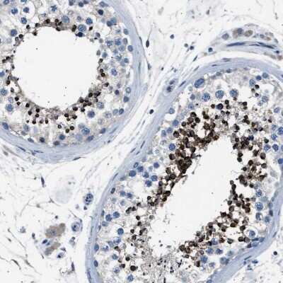 Immunohistochemistry-Paraffin: LRRC37B Antibody [NBP1-91094] - Staining of human testis shows cytoplasmic positivity in cells in seminiferous ducts.