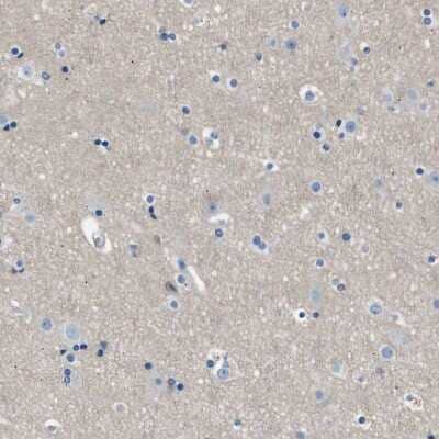 Immunohistochemistry-Paraffin: LRRC37B Antibody [NBP1-91094] - Staining of human cerebral cortex shows no positivity in neurons as expected.