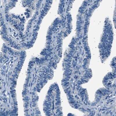 Immunohistochemistry-Paraffin: LRRC37B Antibody [NBP1-91094] - Staining of human fallopian tube shows no positivity in glandular cells as expected.