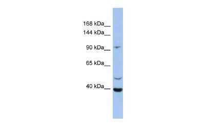 Western Blot: LRRC37B Antibody [NBP2-83154] - WB Suggested Anti-LRRC37B Antibody Titration: 0.2-1 ug/ml. ELISA Titer: 1:1562500. Positive Control: OVCAR-3 cell lysate