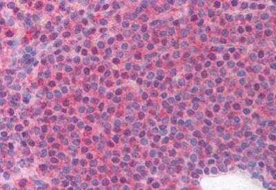 Immunohistochemistry-Paraffin: LRRC3B/LRP15 Antibody [NBP1-02562] - Staining of human spleen. Immunohistochemistry of formalin-fixed, paraffin-embedded tissue after heat-induced antigen retrieval. Antibody concentration 5 ug/ml.
