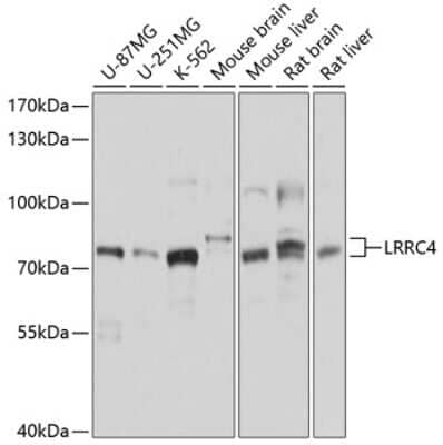 Western Blot: LRRC4 Antibody [NBP3-05099] - Analysis of extracts of various cell lines, using LRRC4 antibody at 1:1000 dilution. Secondary antibody: HRP Goat Anti-Rabbit IgG (H+L) at 1:10000 dilution. Lysates/proteins: 25ug per lane. Blocking buffer: 3% nonfat dry milk in TBST. Detection: ECL Basic