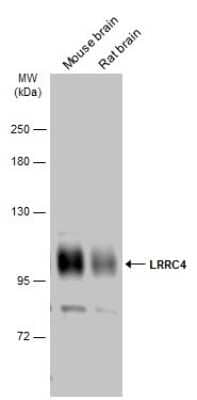 Western Blot: LRRC4 Antibody [NBP3-13186] - Various tissue extracts (75 ug) were separated by 7.5% SDS-PAGE, and the membrane was blotted with LRRC4 antibody (NBP3-13186) diluted at 1:1000. The HRP-conjugated anti-rabbit IgG antibody (NBP2-19301) was used to detect the primary antibody.