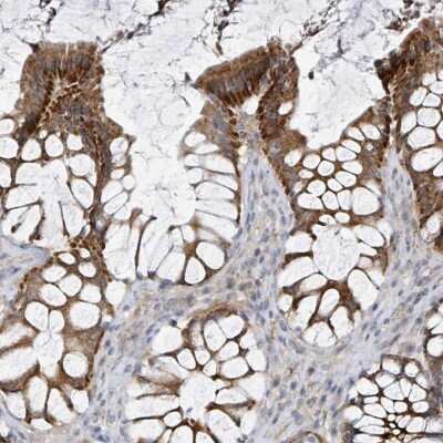 Immunohistochemistry-Paraffin: LRRC42 Antibody [NBP2-30483] - Staining of human rectum shows distinct cytoplasmic positivity in glandular cells.