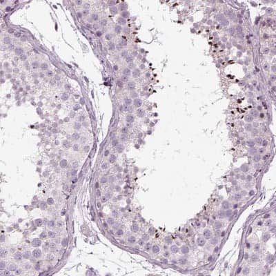 Immunohistochemistry-Paraffin: LRRC44 Antibody [NBP1-92078] - Staining of human testis shows strong cytoplasmic positivity in spermatozoa.