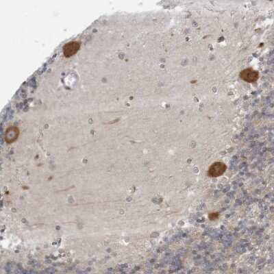 Immunohistochemistry-Paraffin: LRRC45 Antibody [NBP1-93510] - Staining of human cerebellum shows moderate cytoplasmic positivity in purkinje cells.