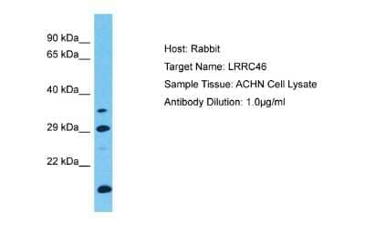 Western Blot: LRRC46 Antibody [NBP2-85229] - Host: Rabbit. Target Name: LRRC46. Sample Type: ACHN Whole Cell lysates. Antibody Dilution: 1.0ug/ml