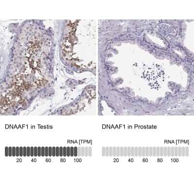 <b>Orthogonal Strategies Validation. </b>Immunohistochemistry-Paraffin: LRRC50 Antibody [NBP2-62685] - Analysis in human testis and prostate tissues using Anti-DNAAF1 antibody. Corresponding DNAAF1 RNA-seq data are presented for the same tissues.