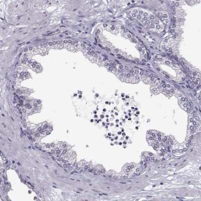 Immunohistochemistry-Paraffin: LRRC50 Antibody [NBP2-62685] - Staining of human prostate shows low expression as expected.