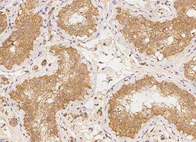 Immunohistochemistry-Paraffin: LRRC50 Antibody [NBP3-05790] -  Staining of human LRRC50 in human testis with rabbit polyclonal antibody at 1:100 dilution.