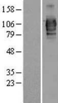 Western Blot: LRRC50 Overexpression Lysate (Adult Normal) [NBL1-12700] Left-Empty vector transfected control cell lysate (HEK293 cell lysate); Right -Over-expression Lysate for LRRC50.