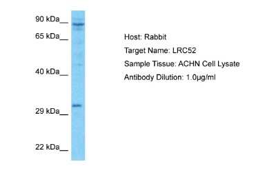 Western Blot: LRRC52 Antibody [NBP2-84148] - Host: Rabbit. Target Name: LRC52. Sample Type: ACHN Whole Cell lysates. Antibody Dilution: 1.0ug/ml