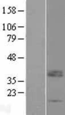 Western Blot: LRRC52 Overexpression Lysate (Adult Normal) [NBP2-08880] Left-Empty vector transfected control cell lysate (HEK293 cell lysate); Right -Over-expression Lysate for LRRC52.
