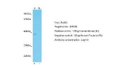 Western Blot: LRRC58 Antibody [NBP2-83160] - Host: Rabbit. Target: LRRC58. Positive control (+): Human Kidney (KI). Negative control (-): Human Placenta (PL). Antibody concentration: 1ug/ml