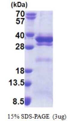 SDS-Page: LRRC59 Protein [NBP2-23191]