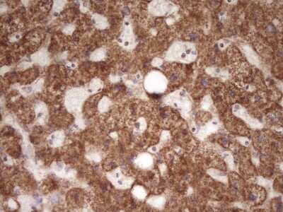 Immunohistochemistry LRRC6 Antibody (OTI7E9)