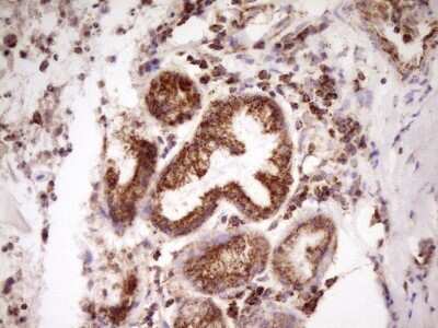 Immunohistochemistry LRRC6 Antibody (OTI7E9)