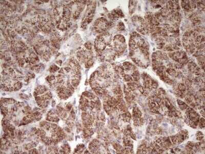 Immunohistochemistry: LRRC6 Antibody (7E9) [NBP2-45674] - Analysis of Human pancreas tissue. (Heat-induced epitope retrieval by 1 mM EDTA in 10mM Tris, pH8.5, 120C for 3min)