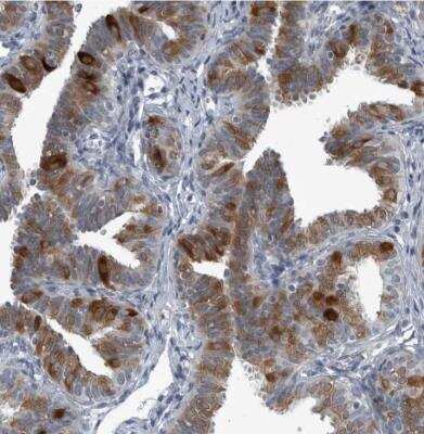 Immunohistochemistry-Paraffin: LRRC6 Antibody [NBP1-82816] - Staining of human fallopian tube shows strong cytoplasmic positivity in a subset of glandular cells.