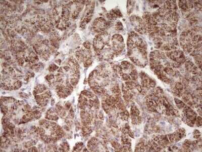 Immunohistochemistry: LRRC6 Antibody (OTI7E9) - Azide and BSA Free [NBP2-72542] - Analysis of Human pancreas tissue. (Heat-induced epitope retrieval by 1 mM EDTA in 10mM Tris, pH8.5, 120C for 3min)