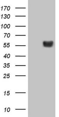 Western Blot: LRRC6 Antibody (OTI7E9) - Azide and BSA Free [NBP2-72542] - Analysis of HEK293T cells were transiently transfected with the pCMV6-ENTRY control (Left lane) or pCMV6-ENTRY LRRC6 .